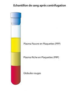 Séparation des composants sanguins après centrifugation